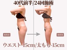 ベモーレ 谷町九丁目 上本町/40代前半/24回施術