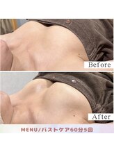 リリーパッソ(Lily passo)/Before After