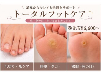 イルミナ(illumina)の写真/【口コミ4.9★】厚い爪・切りにくい爪・魚の目・タコをケア！