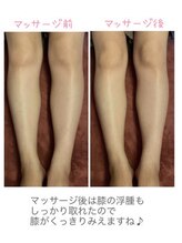 ソレイユ デ オッペン(Soleil De OPPEN)/足ってこんなにむくんでるんです