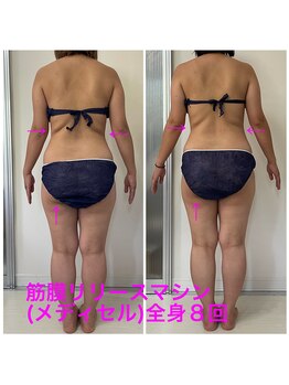 セルビューティー(Cell Beauty)/20代、筋膜リリース全身8回