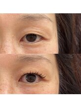 スリール(sourire)/＆Healthy×フラット１0０本