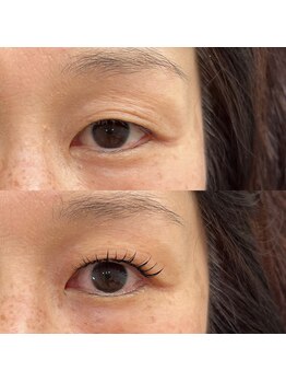 スリール(sourire)/＆Healthy×フラット１0０本