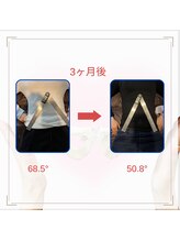 和ぎ整体院/肋骨矯正で改善