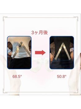 和ぎ整体院/肋骨矯正で改善