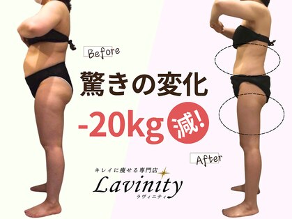 ラヴィニティ 池袋店(Lavinity)の写真