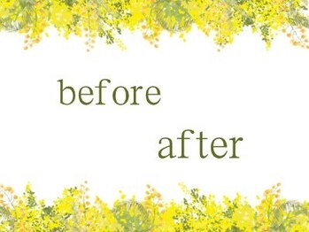 アイレ 桑名(aire)/施術の様子