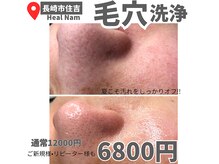 ヒルナム(Heal Nam)