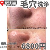 ヒルナム(Heal Nam)