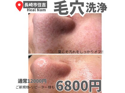ヒルナム(Heal Nam)の写真