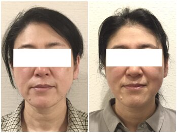 美容整体 ウェリナ 蟹江院/小顔矯正/骨盤矯正/美脚サロン