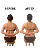 エミニー(EMINY)/