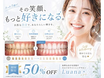 ルアナ(Luana)の写真