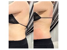 ドクターエイジレス(DR.AGELESS)の雰囲気（脂肪冷却コースでは1回で結果が出せるまでアプローチします。）
