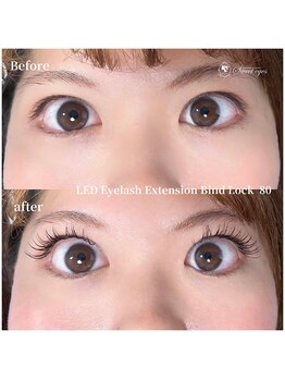スウィートアイズ(Sweet eyes)/LEDバインドロック80束