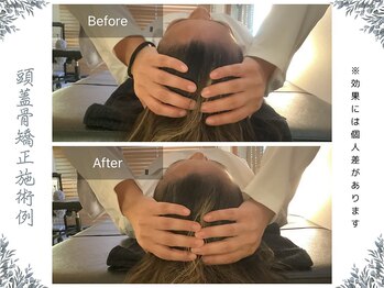 ボディ リセット アンド デザイン(Body Reset & Design)/【施術例】ビフォーアフター