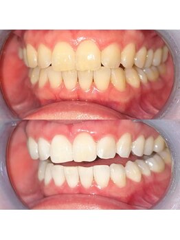 ライトビューティー 池袋店(LightBeauty)/症例写真