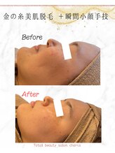 カリス(charis)/フェイスラインスッキリ♪