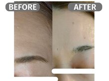 インフィニート 上野毛(infinito)/★BEFORE/AFTER★