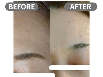 インフィニート 上野毛(infinito)/★BEFORE/AFTER★