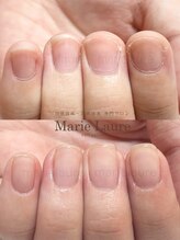 マリーロール 淀屋橋本店(Marie Laure)/自爪育成/深爪矯正/ネイルケア