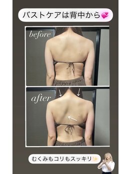 イーストモア(EAST MOIS)/バストアップ1回の効果