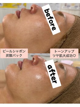 シロ(SHIRO)/ターンオーバー促進艶肌！