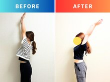 シールド バイ ココイロ(SHIELD by COCOIRO)/予防美容整体【骨膜整体】B＆A