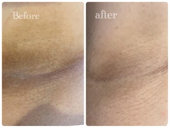 ヒメミ(Himemi)/ローマピンク 脇