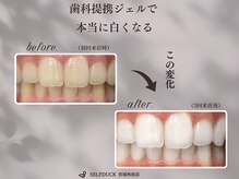 歯科提携ホワイトニングサロン SELFDUCK セルフダック 宮城角田店