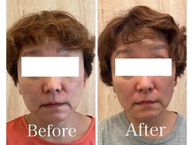 サロンベイビー 西宮本店(Salon Baby)/小顔×リンパで相乗効果