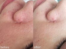 プシュケ(Psyche)の雰囲気（フォトギャラリー、サロンInstagramにてbeforeafter掲載中♪）