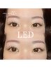 【LED】フラットラッシュ100本