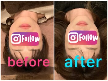 たけ整体院/【小顔矯正　むくみ・たるみ】