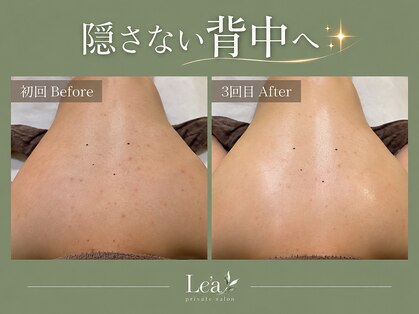 レア(Le'a)の写真