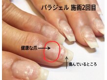 ネイルギャラリーアヴァン(NAIL GALLERY Avant)/パラジェル★自爪に優しい！