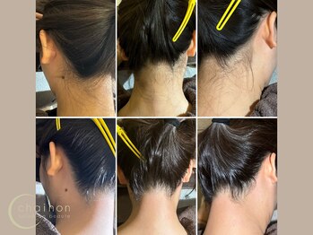 シェノン(chainon)/Before/After 【うなじwax】