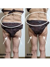 サロン ド ベルメール(Salon de Belle mer)/リンパマッサージ/痩身/リンパ