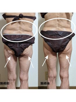 サロン ド ベルメール(Salon de Belle mer)/リンパマッサージ/痩身/リンパ