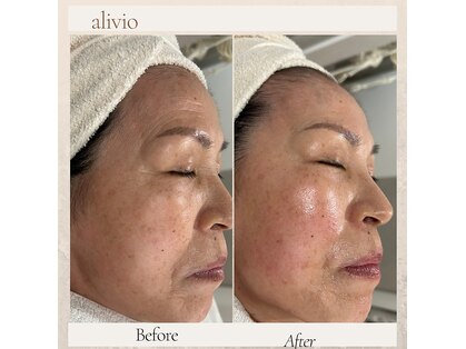 アリビオ(alivio)の写真