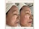 アリビオ(alivio)の写真