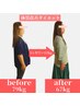【鍼灸師が提案◎らくらくダイエット】運動なしの酵母鍼灸ダイエットコース