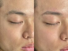 アオアイラッシュ 渋谷 表参道(ao.eyelash)/顔・骨格に合わせたデザイン