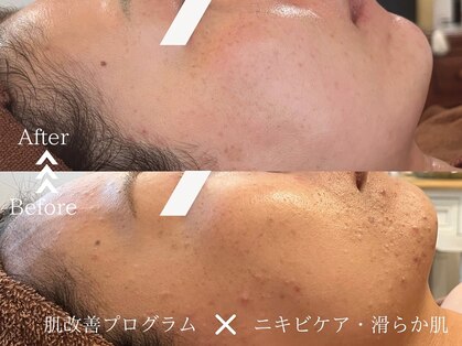 ラヴェリテ(La verite)の写真