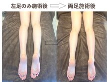 フィオーレ 麻布十番(Fiore)/筋膜ケアで脚が伸びます