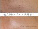 ウェヌ(VENE)の写真/【取り扱い希少!!】オーガニック成分マツヤニwaxで気になる毛穴のお悩みを改善♪ワントーン明るいお肌へ★