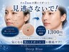 【1mm単位のオーダーメイド】気になるイボ・シミアタック(1mm/1,100円~)