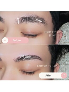 シャルトルズ 広島八丁堀店/症例写真７