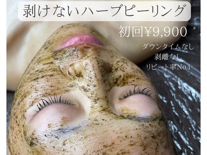 ミロン(miron)の写真