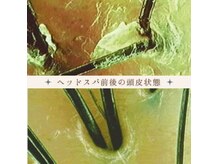 ベル(belle)の雰囲気(施術前と後の頭皮の状態もチェックできます◎ヘッドスパ/ヘッド)